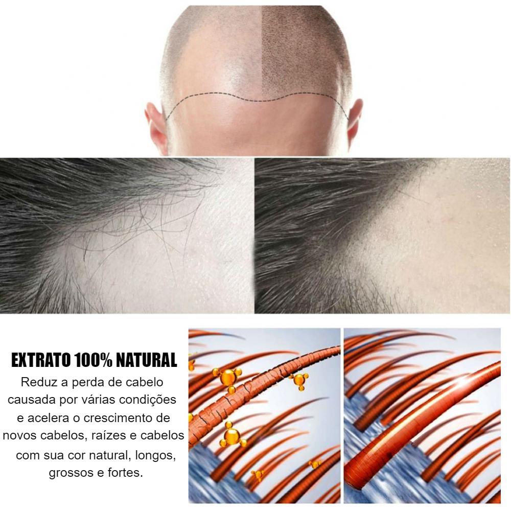 Óleo Anti Queda de Cabelo - Crescimento/Fortalecimento Rápido - 20 ml