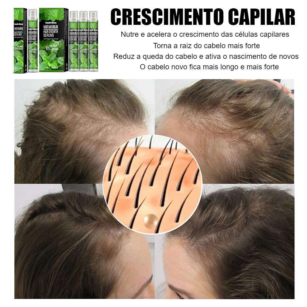 Regeneração e Crescimento do Cabelo - Extrato de Gengibre - Pulverizador Unisex