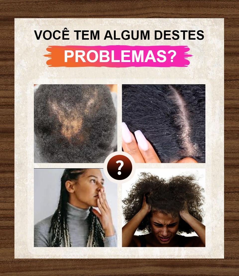 Óleo Para Crescimento do Cabelo - Anti-Queda, Engrossamento e Fortalecimento - Óleo de Chede