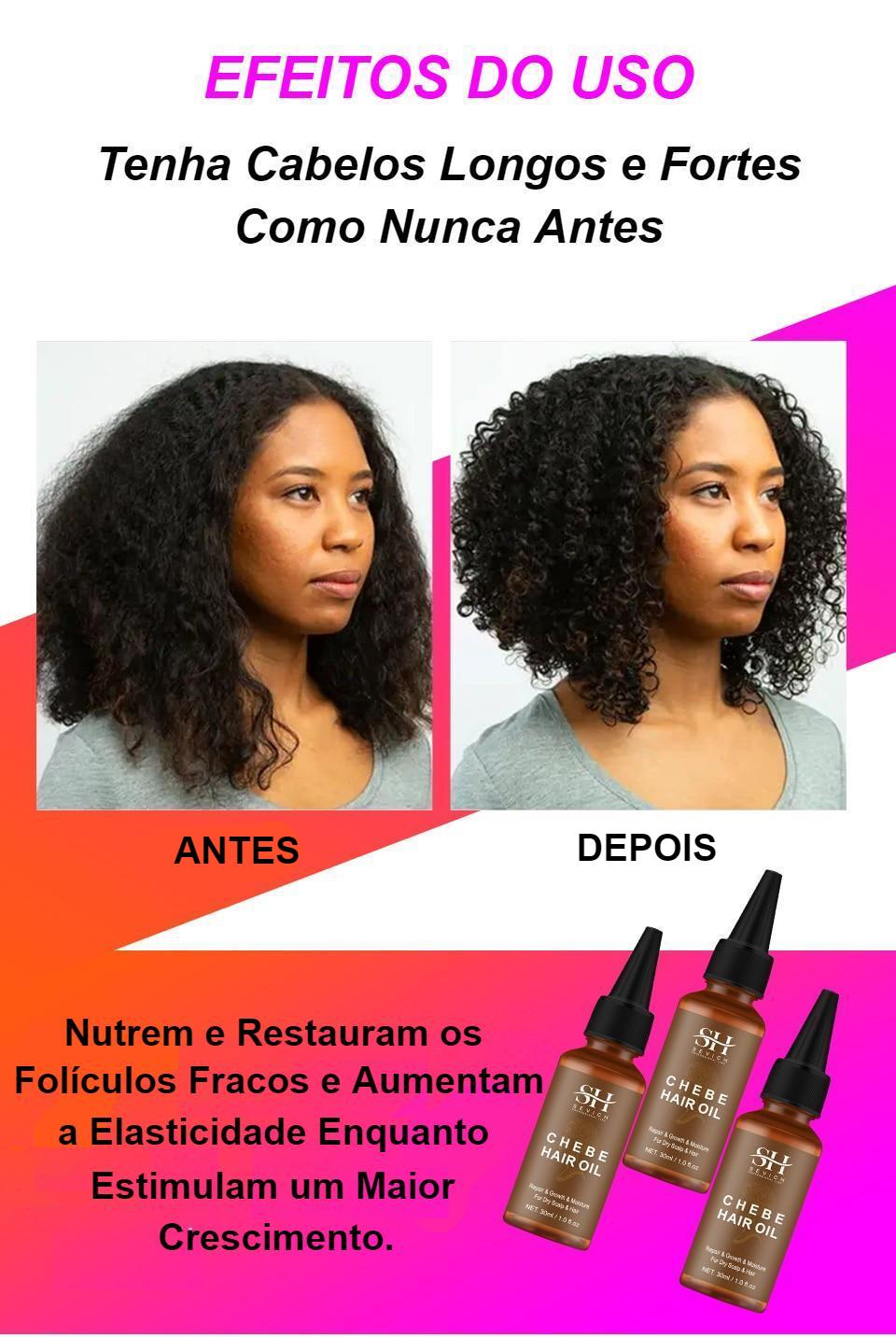 Óleo Para Crescimento do Cabelo - Anti-Queda, Engrossamento e Fortalecimento - Óleo de Chede