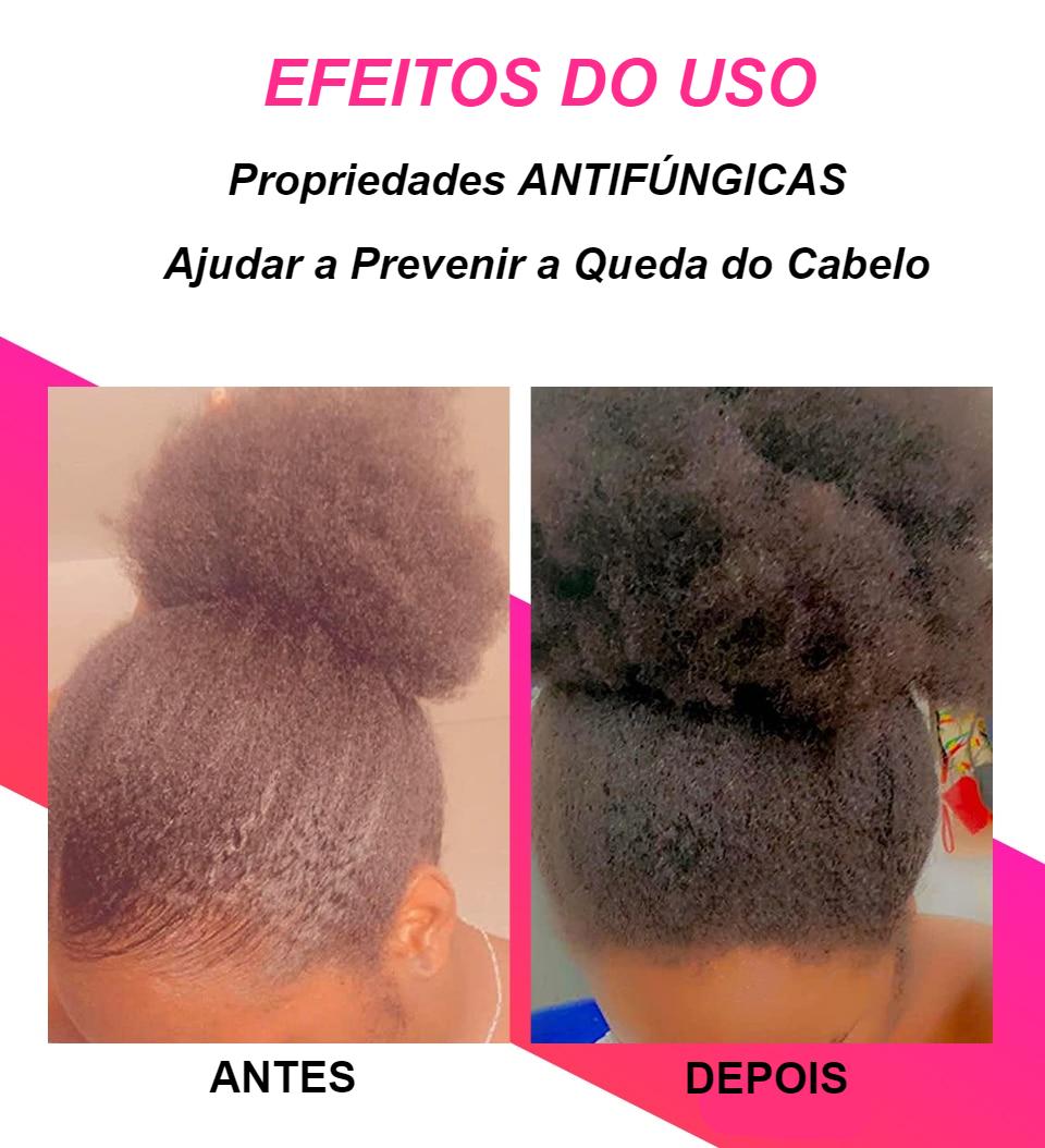 Óleo Para Crescimento do Cabelo - Anti-Queda, Engrossamento e Fortalecimento - Óleo de Chede