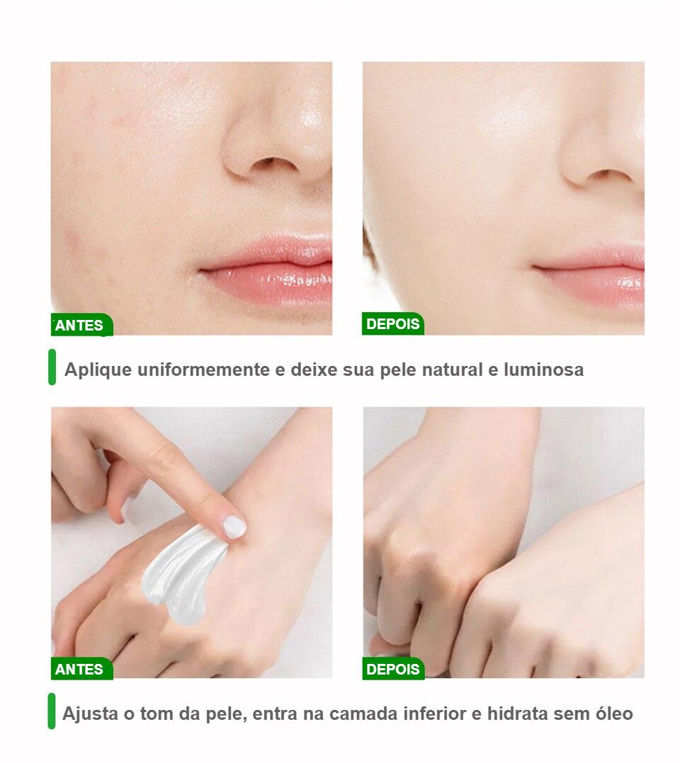 Retinol - Creme Clareador da Pele - Remove Pigmentação