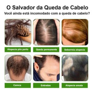 Óleo Anti Queda de Cabelo - Crescimento/Fortalecimento Rápido - 20 ml